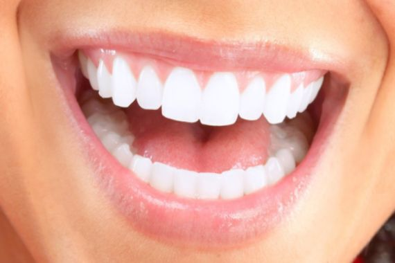 Blanqueamiento o Aclaramiento Dental Clinica Dental Oralvant Ibague Colombia